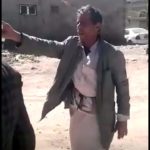 جريمة بشعة تهز العاصمة صنعاء .. حوثي يعتدي على مواطن بالطعن بالجنبية في راسة ~  صور